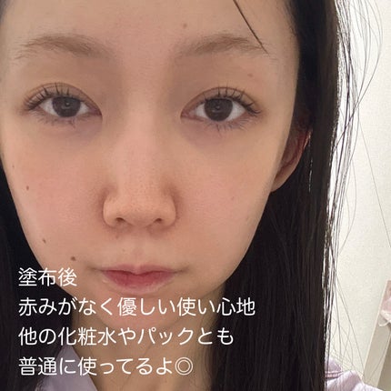 レチノール 0.2 ブースティングショット アンプル/SKIN1004/美容液を使ったクチコミ(4枚目)