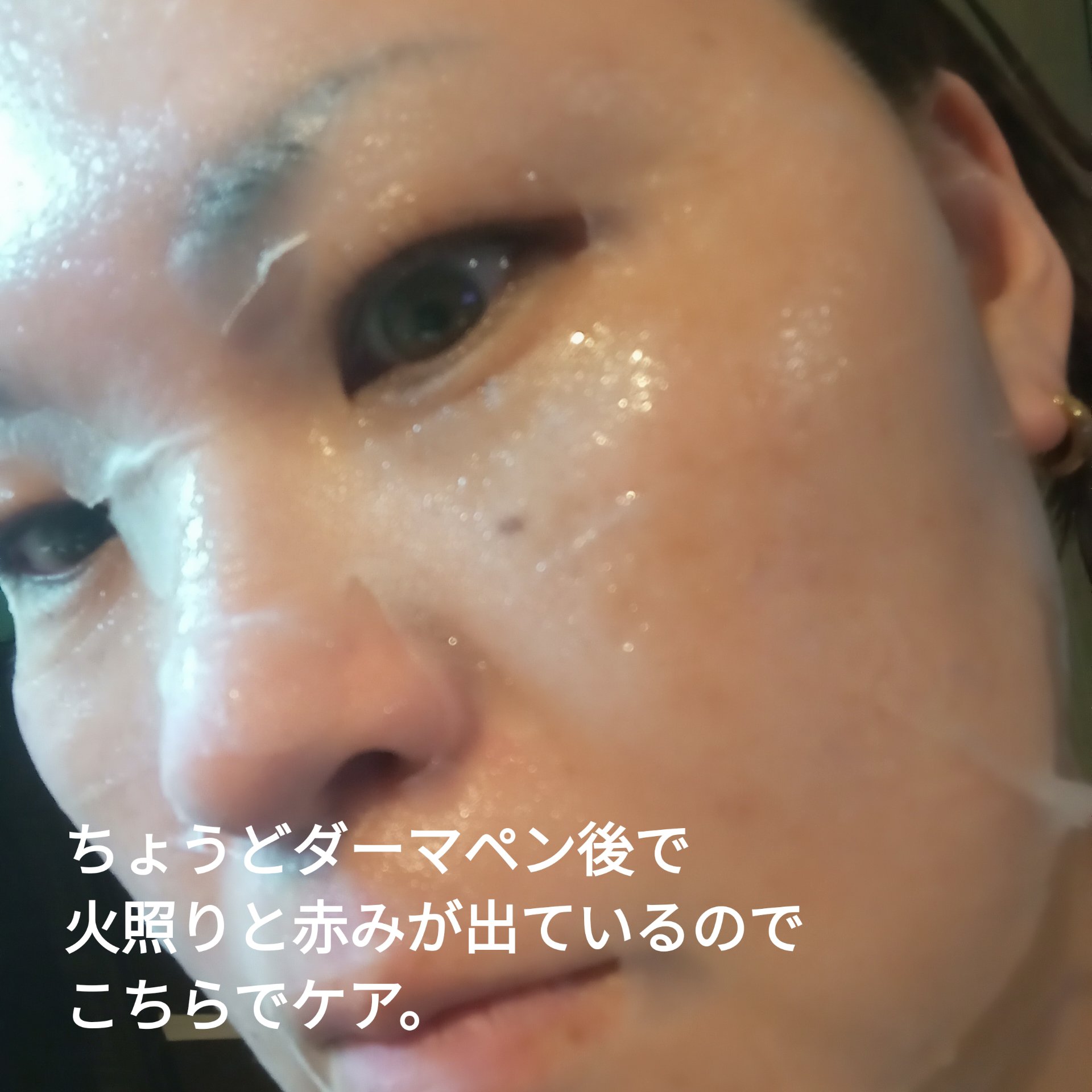 PHセンシティブマスク クールフィット/SAM'U/シートマスク・パックを使ったクチコミ（3枚目）