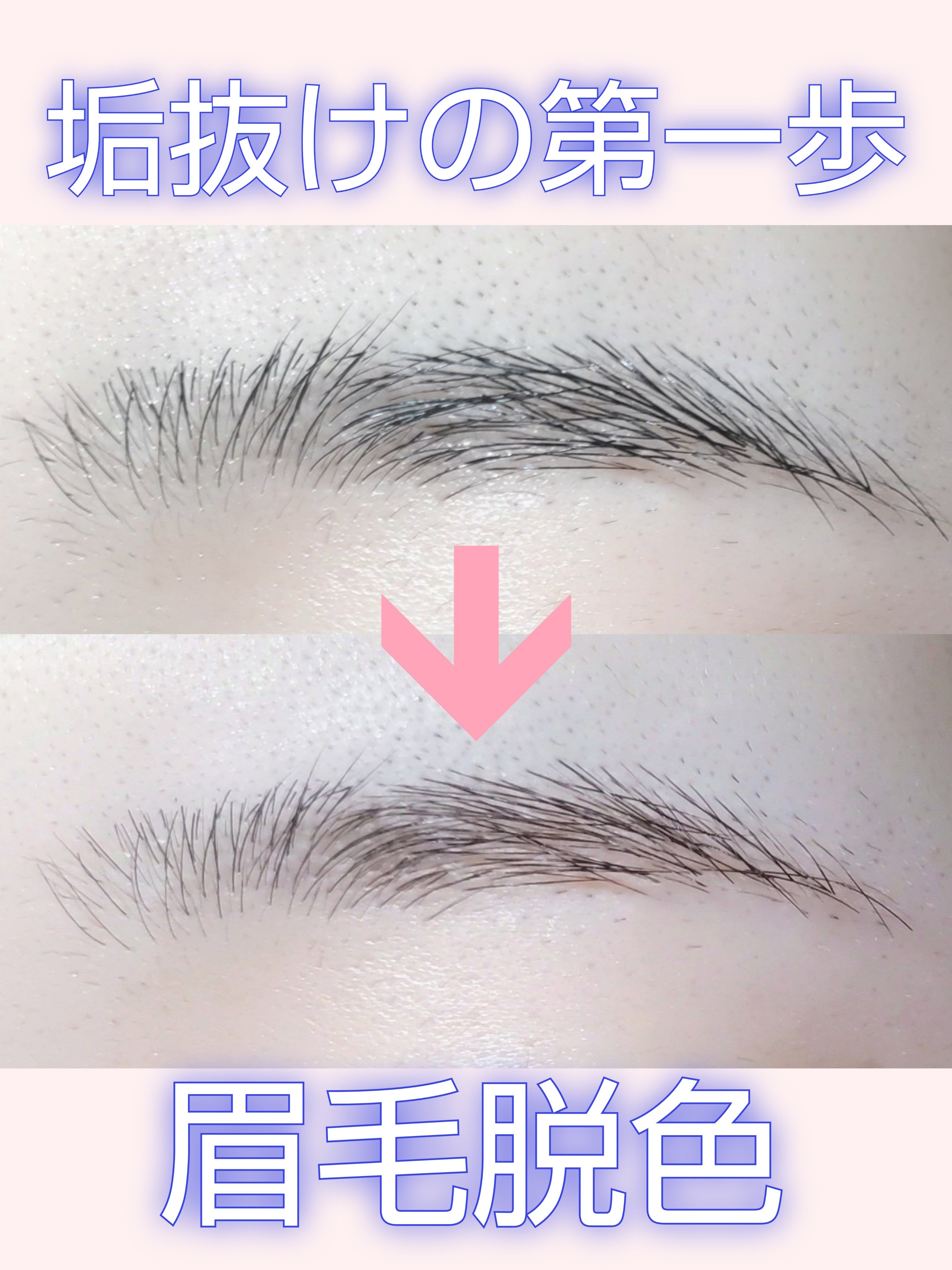 脱色クリーム 敏感肌用/エピラット/ムダ毛ケアを使ったクチコミ（1枚目）