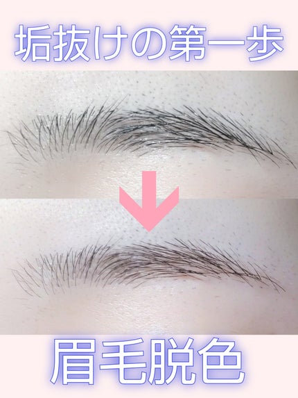 脱色クリーム 敏感肌用/エピラット/ムダ毛ケアを使ったクチコミ(1枚目)