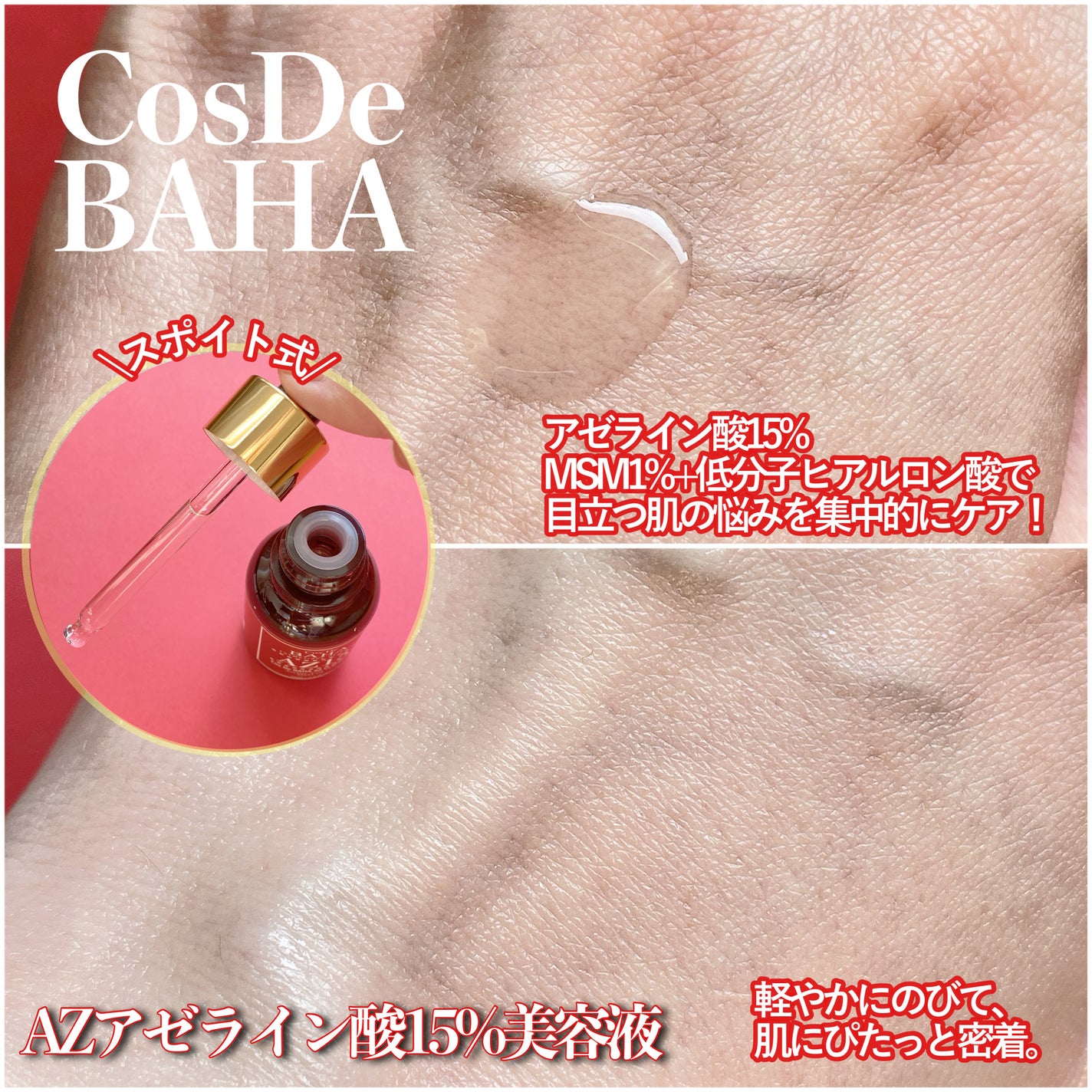 AZアゼライン酸15セラム/コスデバハ/美容液を使ったクチコミ(2枚目)