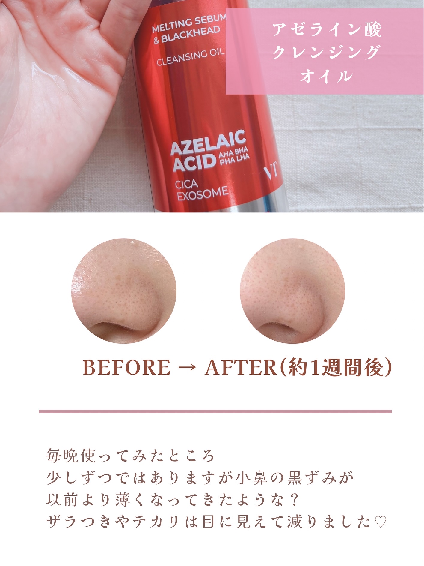 ガーリックリードルショット ジェルクリーム/VT/フェイスクリームを使ったクチコミ（3枚目）