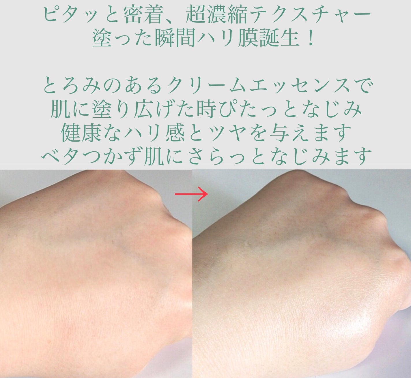 PDRN+リードルS 100/VT/美容液を使ったクチコミ(3枚目)