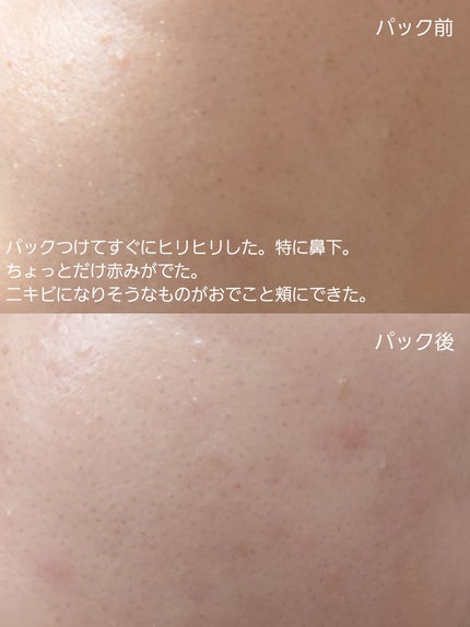 3番 すべすべキメケアシートマスク/numbuzin/シートマスク・パックを使ったクチコミ(2枚目)