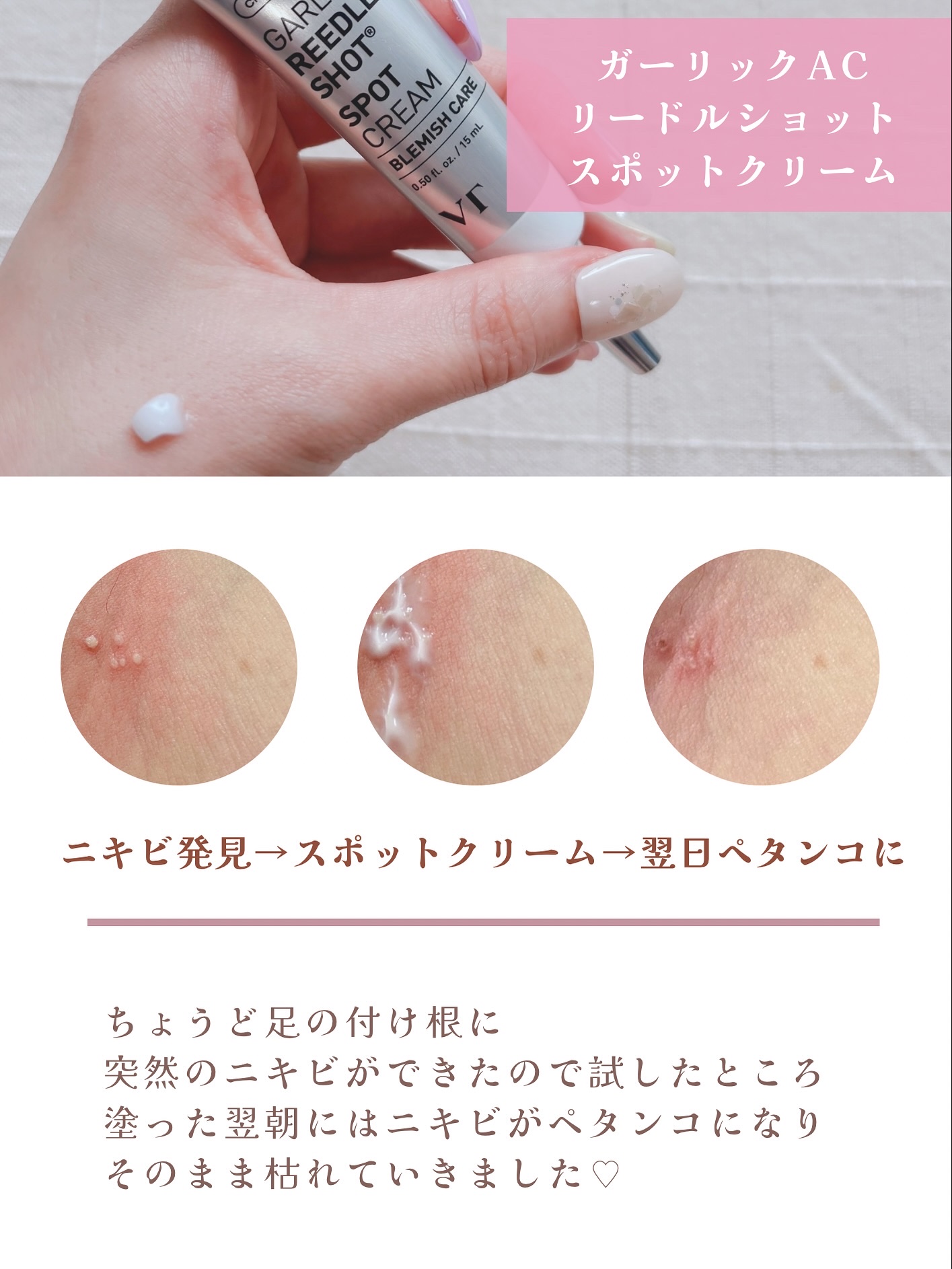 ガーリックリードルショット ジェルクリーム/VT/フェイスクリームを使ったクチコミ（2枚目）