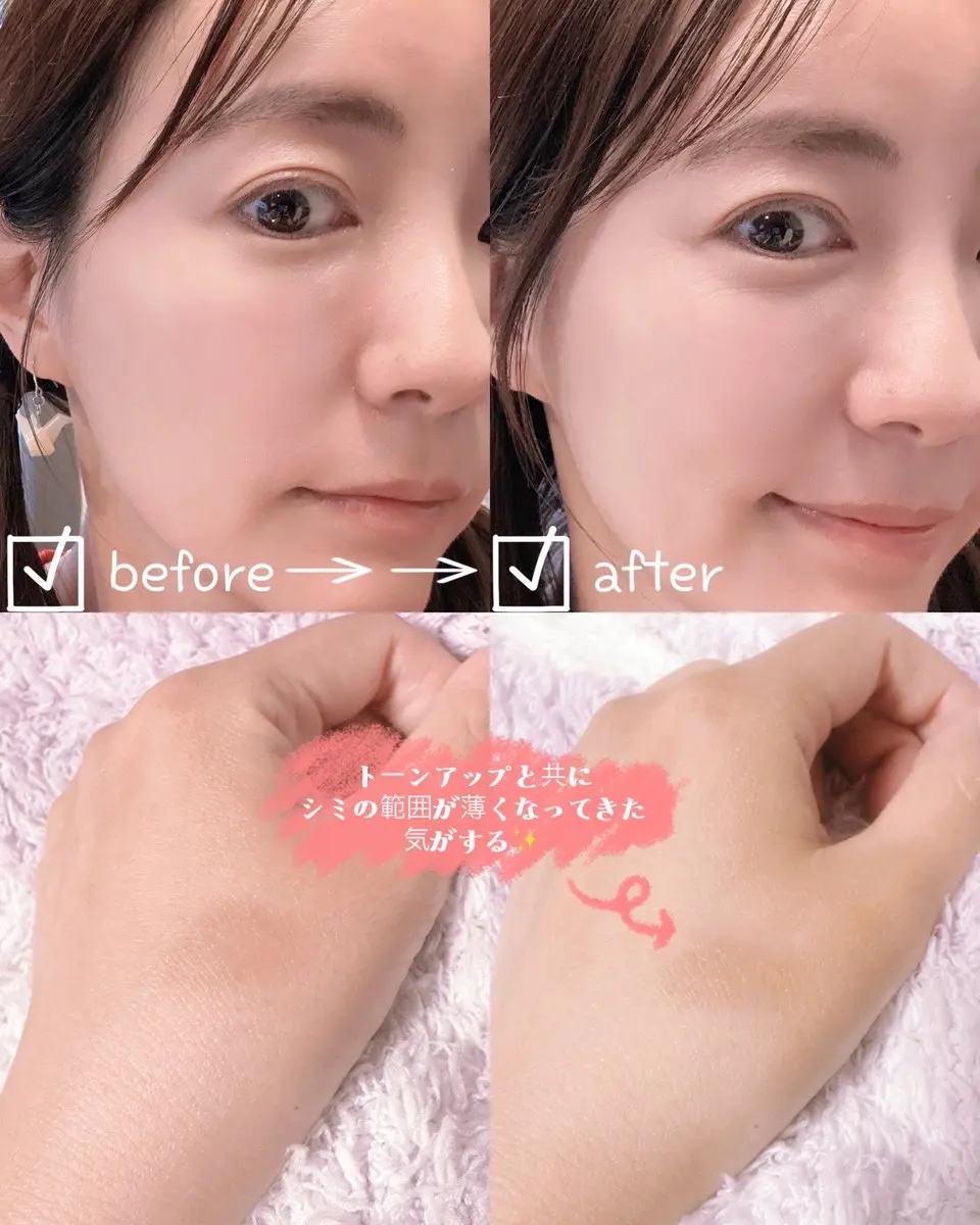 アルブチン スキンブースター セラム/MEDITHERAPY/美容液を使ったクチコミ（3枚目）