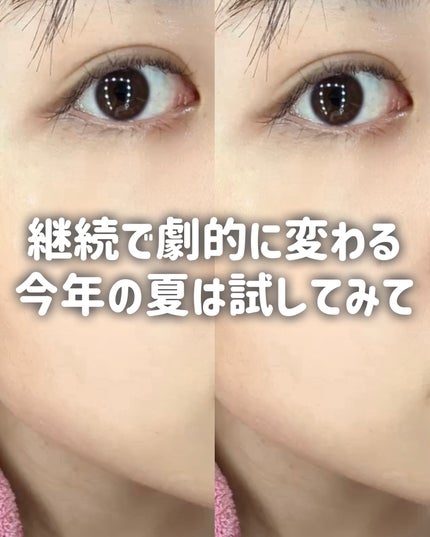 潤浸保湿 乳液/キュレル/乳液を使ったクチコミ(9枚目)