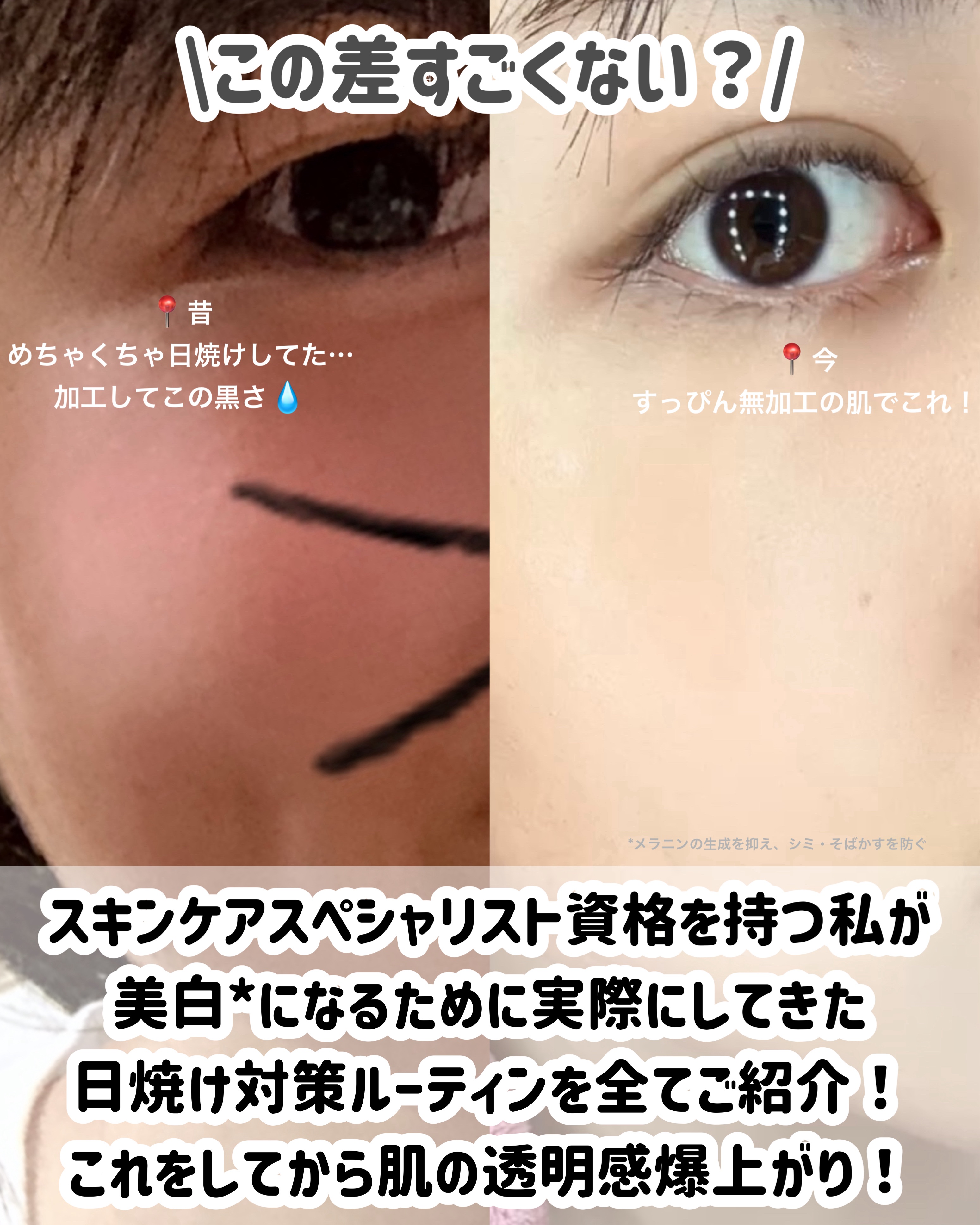 潤浸保湿 乳液/キュレル/乳液を使ったクチコミ（2枚目）