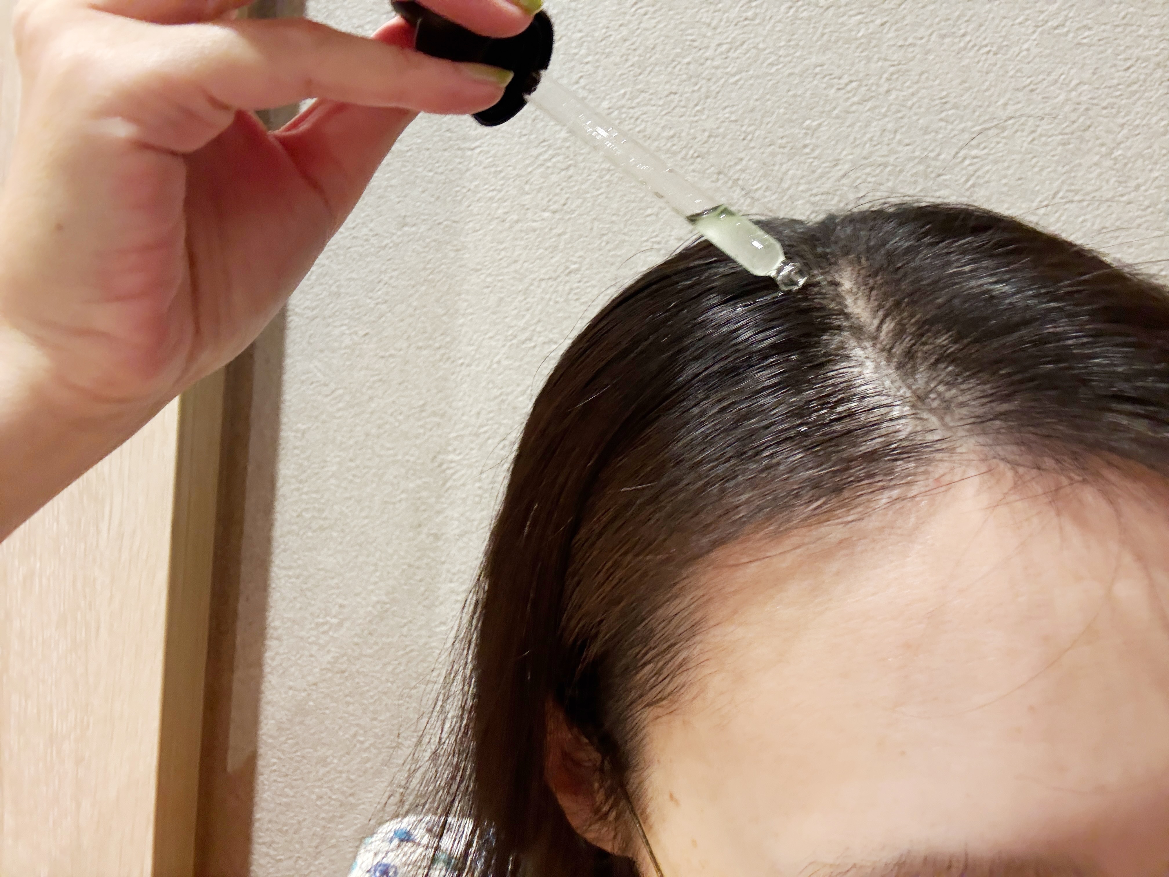 薬用 メディカル アンチヘアロスセラム/L'OCCITANE/頭皮ローションを使ったクチコミ（3枚目）