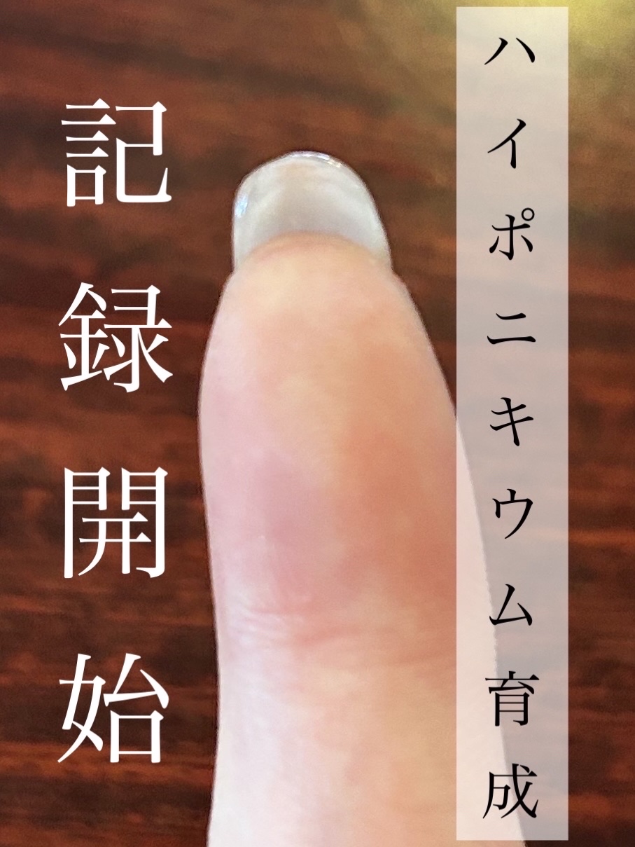⚫︎ハイポニキウムとは？？

爪と指の間にある皮膚のこと！
（画像2枚め参照！）
ここがしっかり育っていることで、爪の白い部分が長くなるので細長く見えるんです！

⚫︎ハイポニキウムを育てるためには？
・爪を道具として使わない！
育成中のハ