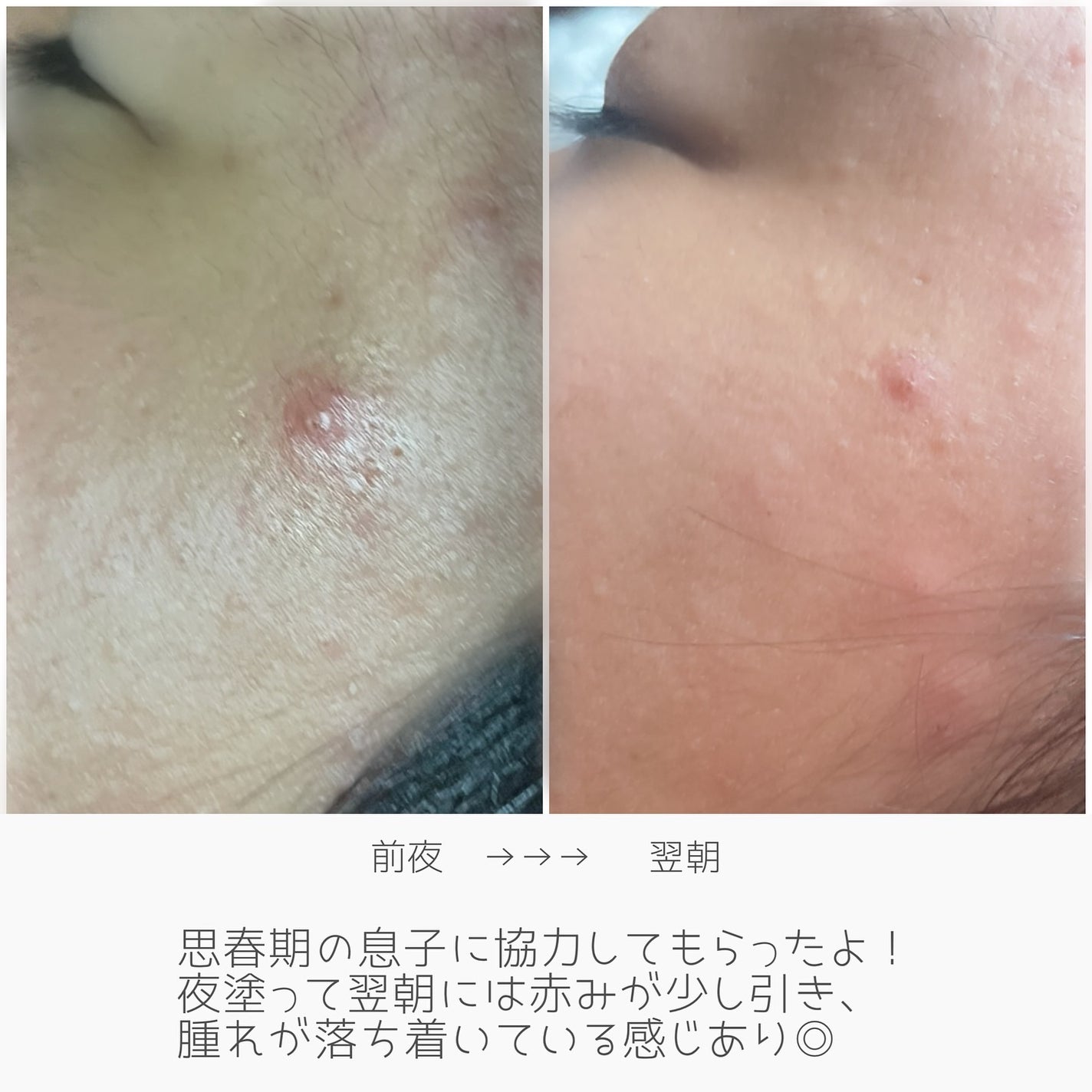 AZケア クレンジングオイル/VT/オイルクレンジングを使ったクチコミ(7枚目)