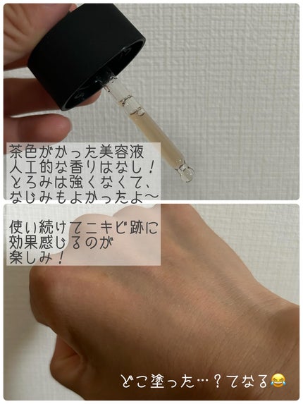 RXザ・アルファアルブチン2 ニキビ跡ケアセラム/COSRX/美容液を使ったクチコミ(3枚目)