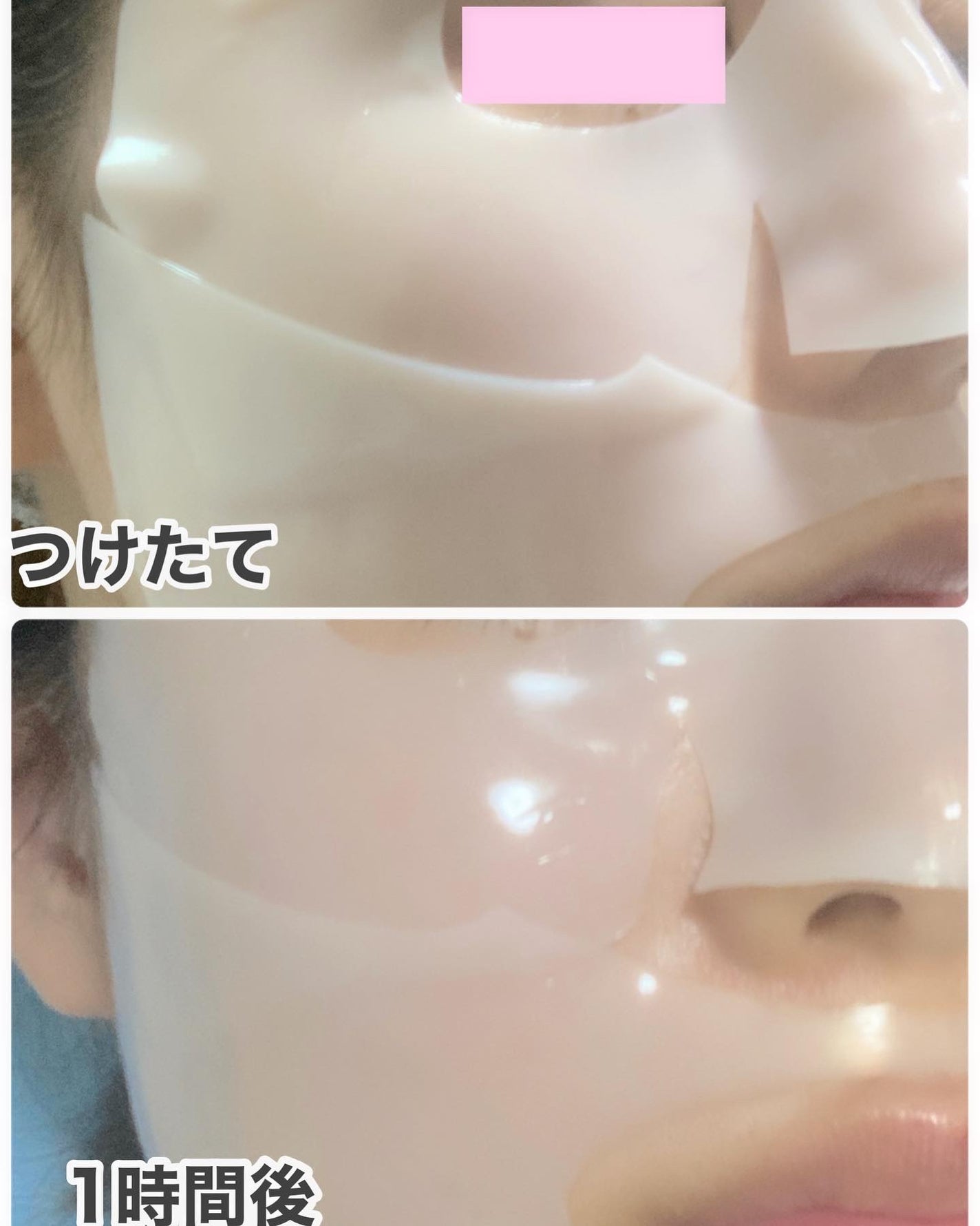 RXザ・アルファアルブチン2 ニキビ跡ケアセラム/COSRX/美容液を使ったクチコミ(4枚目)