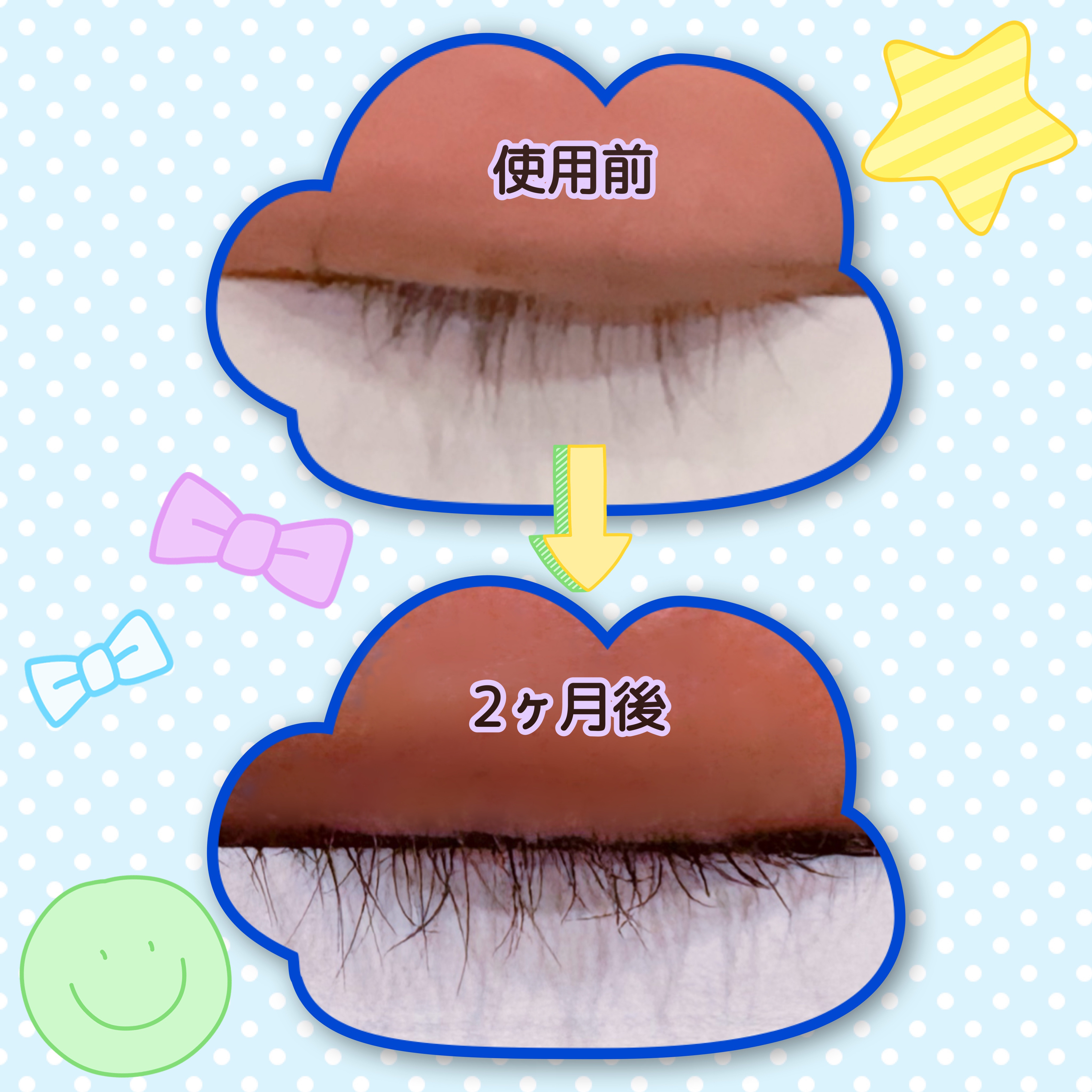 ラッシュリッチアイラッシュセラム/ロート製薬/まつげ美容液を使ったクチコミ（3枚目）