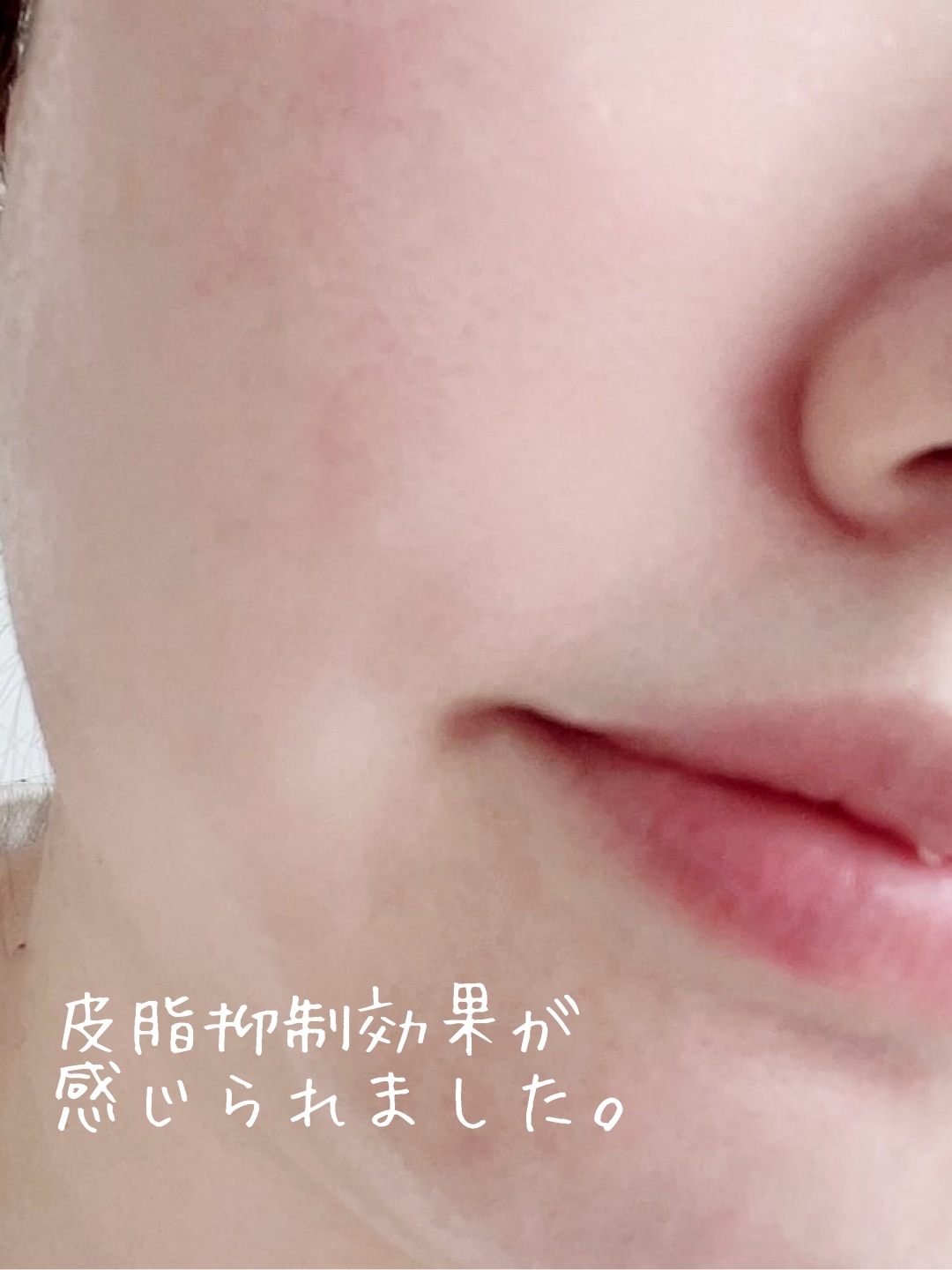 アゼライン酸15 インテンスカーミングセラム/Anua/美容液を使ったクチコミ（3枚目）