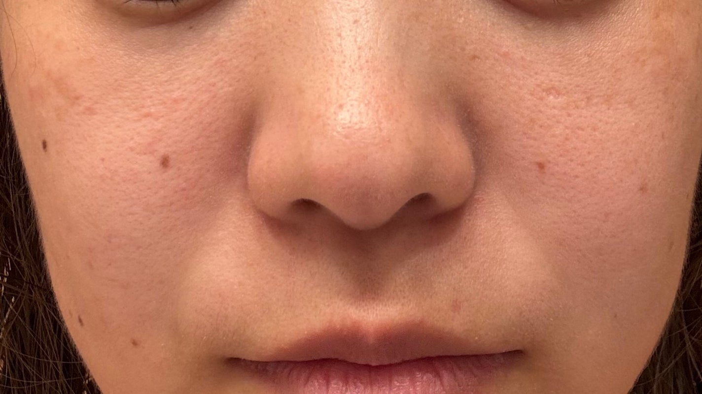 りいこ on LIPS 「肌断食をはじめてから22日目3週間経ちましたが、劇的な変化はな..」(2枚目)