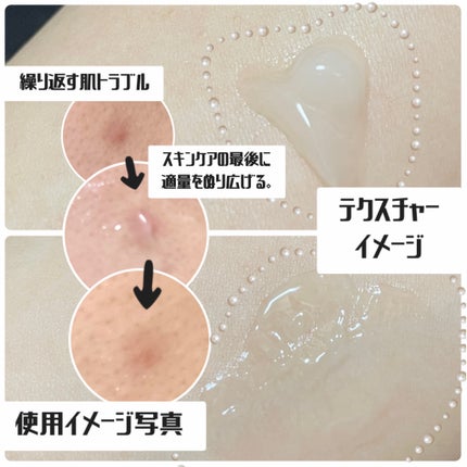 AZケア クレンジングオイル/VT/オイルクレンジングを使ったクチコミ(5枚目)