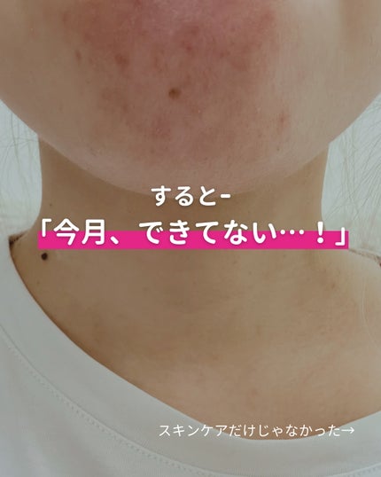 Yuka¦アラサーからの頑張らないスキンケア on LIPS 「こんにちは♪"アラサーからの頑張らないスキンケア"について発信..」(7枚目)