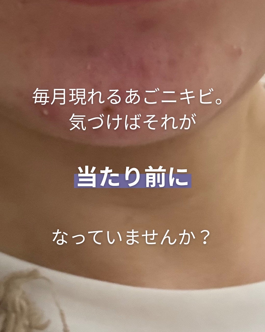 Yuka¦アラサーからの頑張らないスキンケア on LIPS 「こんにちは♪"アラサーからの頑張らないスキンケア"について発信..」(2枚目)