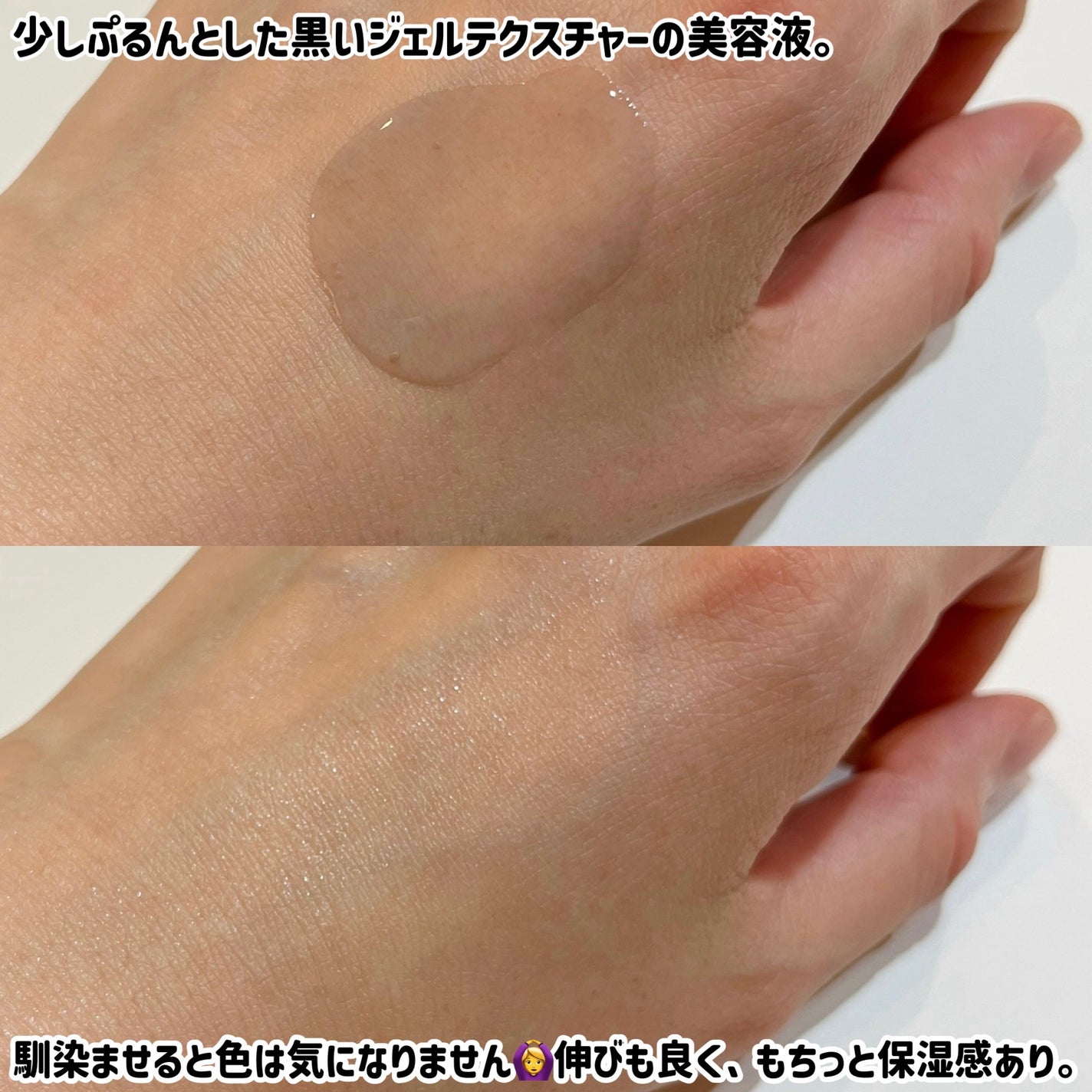 ブラックPDRN 美容液/ネイチャーリパブリック/美容液を使ったクチコミ(3枚目)