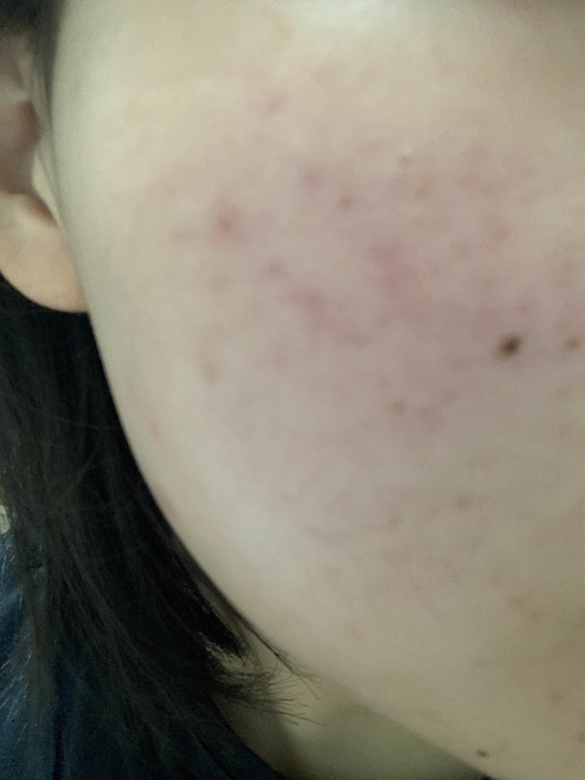 明色美顔水 薬用化粧水/美顔/化粧水を使ったクチコミ（3枚目）