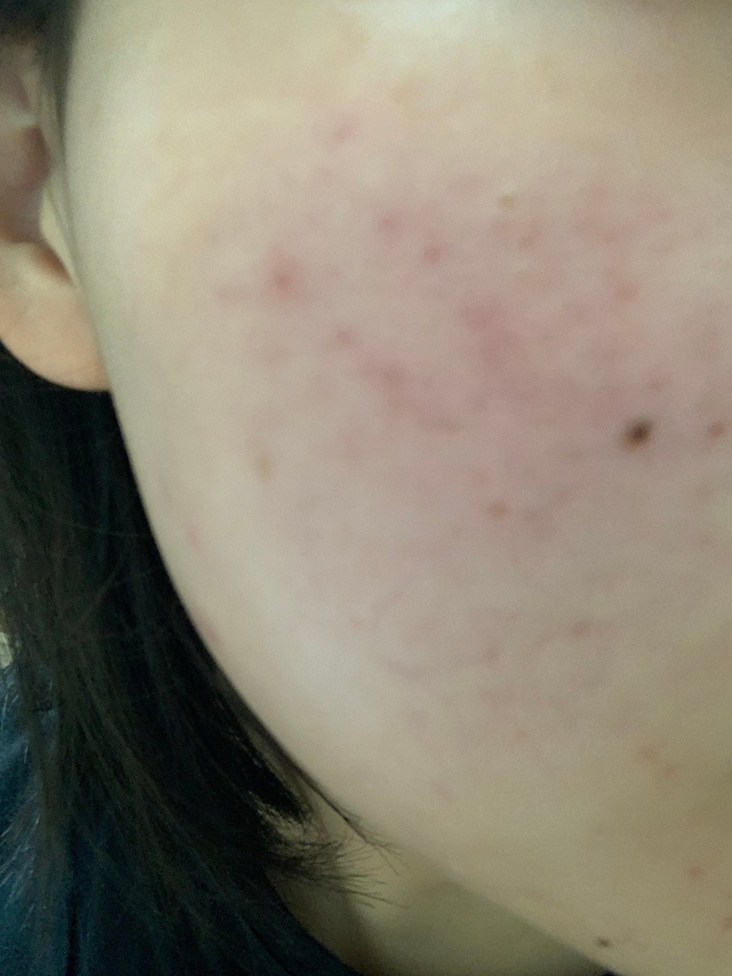 明色美顔水 薬用化粧水/美顔/化粧水を使ったクチコミ(3枚目)