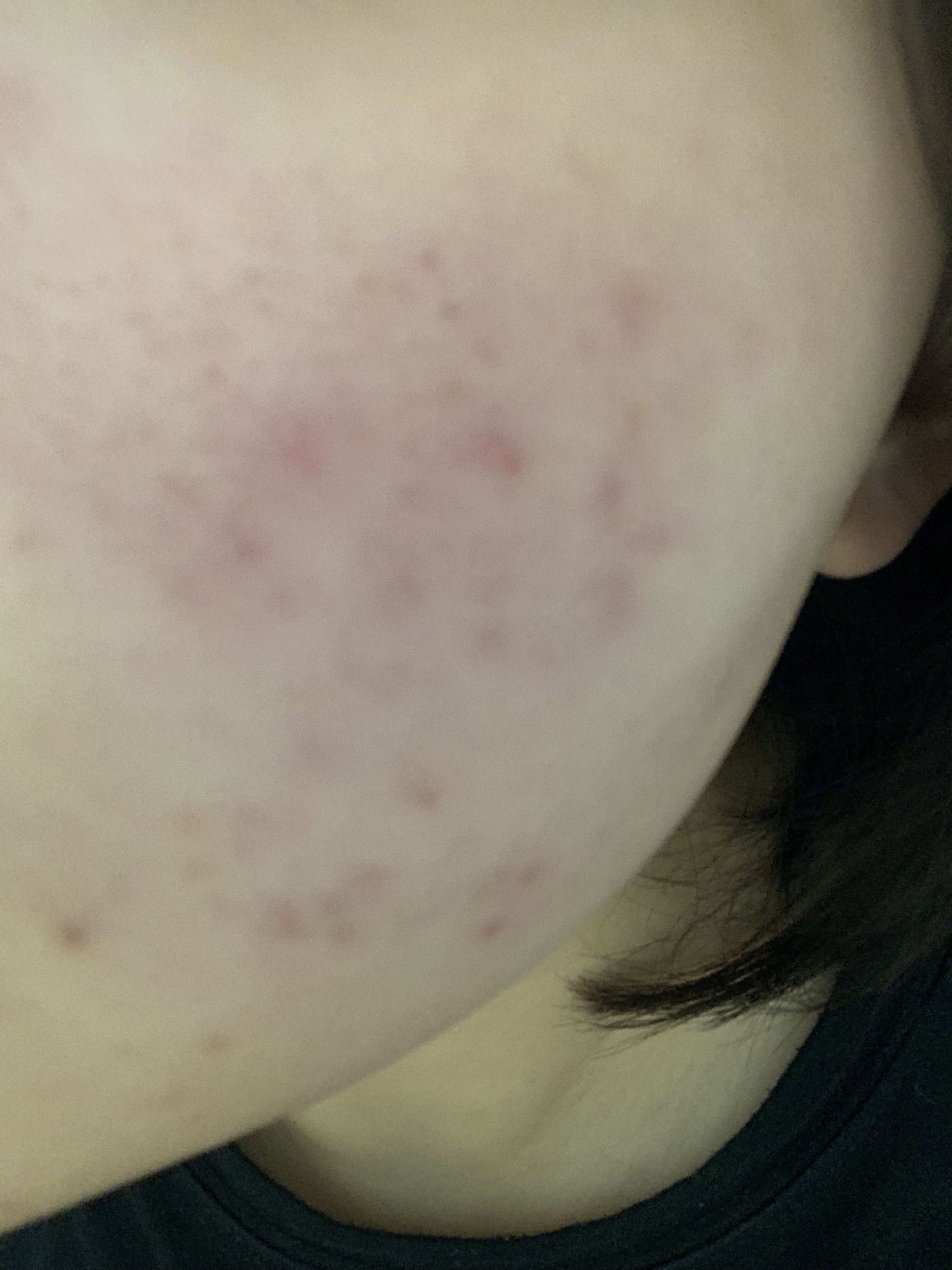 明色美顔水 薬用化粧水/美顔/化粧水を使ったクチコミ（2枚目）