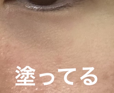 アイファルトアイバッククリーム/Dr.Melaxin/アイケア・アイクリームを使ったクチコミ（3枚目）