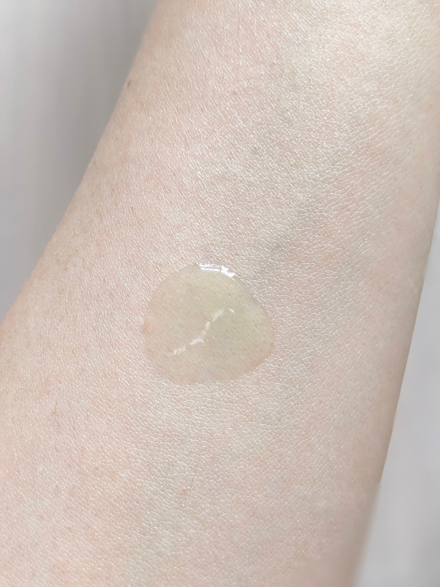 アゼライン酸15 インテンスカーミングセラム/Anua/美容液を使ったクチコミ(3枚目)