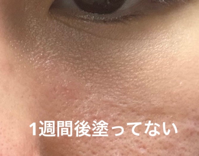 アイファルトアイバッククリーム/Dr.Melaxin/アイケア・アイクリームを使ったクチコミ(4枚目)