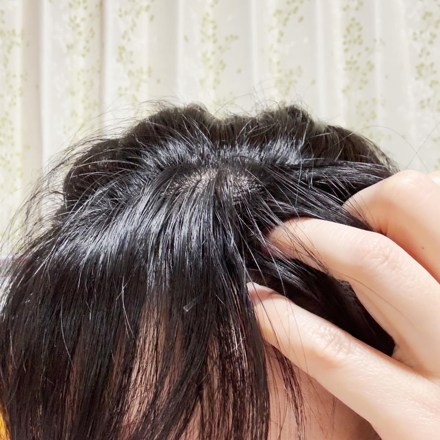 薬用 メディカル アンチヘアロスセラム/L'OCCITANE/頭皮ローションを使ったクチコミ(6枚目)