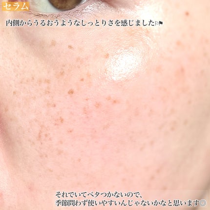 ポア ブライトニング シミケアセラム/celimax/美容液を使ったクチコミ(5枚目)