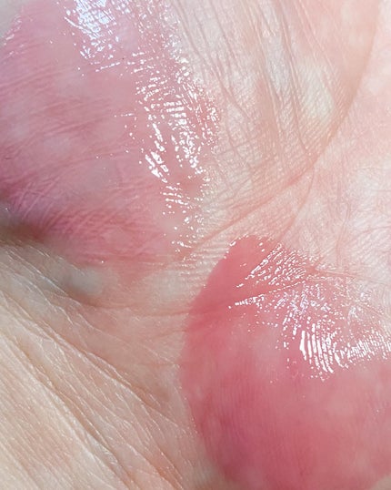 グラッシーレイヤーティント/LUNA/リップティントを使ったクチコミ(5枚目)