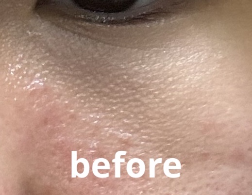 アイファルトアイバッククリーム/Dr.Melaxin/アイケア・アイクリームを使ったクチコミ（2枚目）