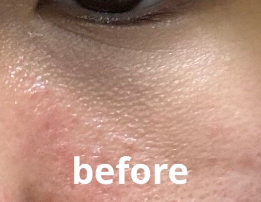 アイファルトアイバッククリーム/Dr.Melaxin/アイケア・アイクリームを使ったクチコミ(2枚目)