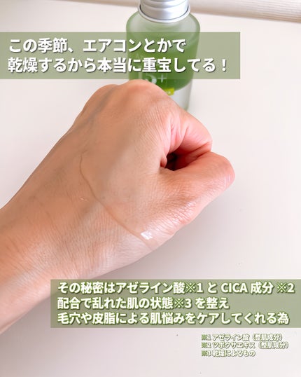 アゼライン酸15 インテンスカーミングセラム/Anua/美容液を使ったクチコミ(6枚目)