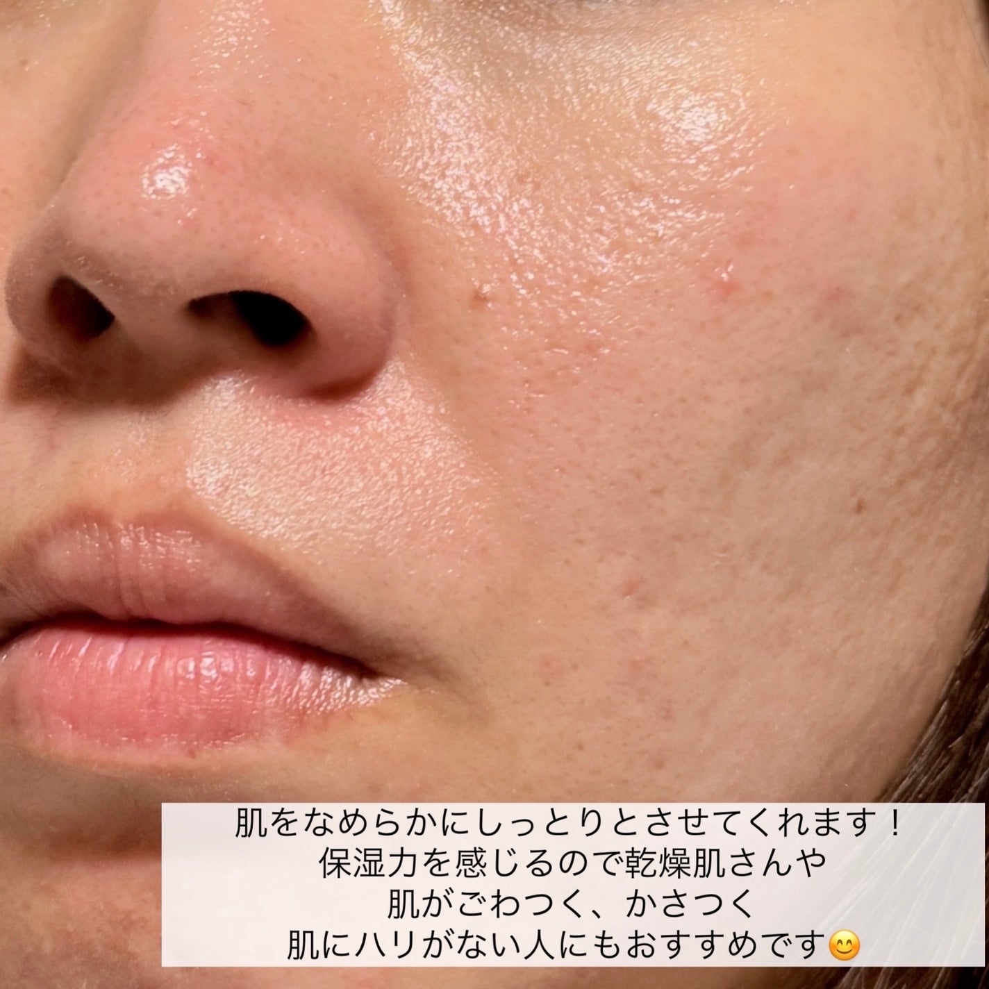 CUREPAIR MELA CREAM /KOPHER/フェイスクリームを使ったクチコミ(6枚目)