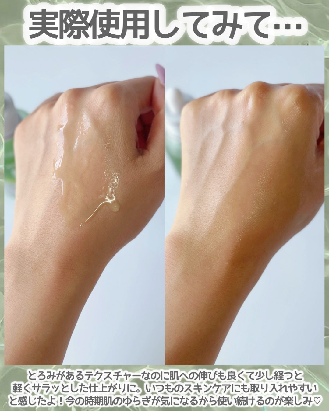 アゼライン酸15 インテンスカーミングセラム/Anua/美容液を使ったクチコミ(3枚目)