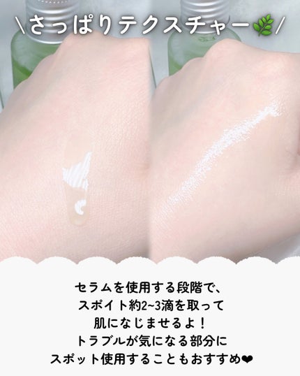 アゼライン酸15 インテンスカーミングセラム/Anua/美容液を使ったクチコミ(3枚目)