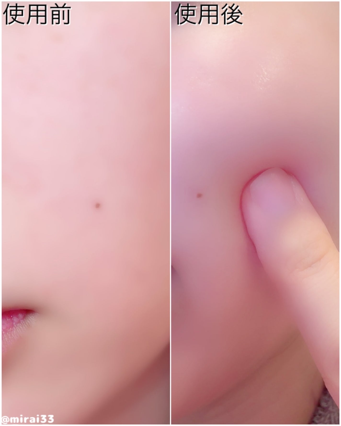 美羅韋♡コスメ•美容オタク on LIPS 「-ブランド:z+piderm商品名:EGFスキンバリアハイドロ..」(3枚目)