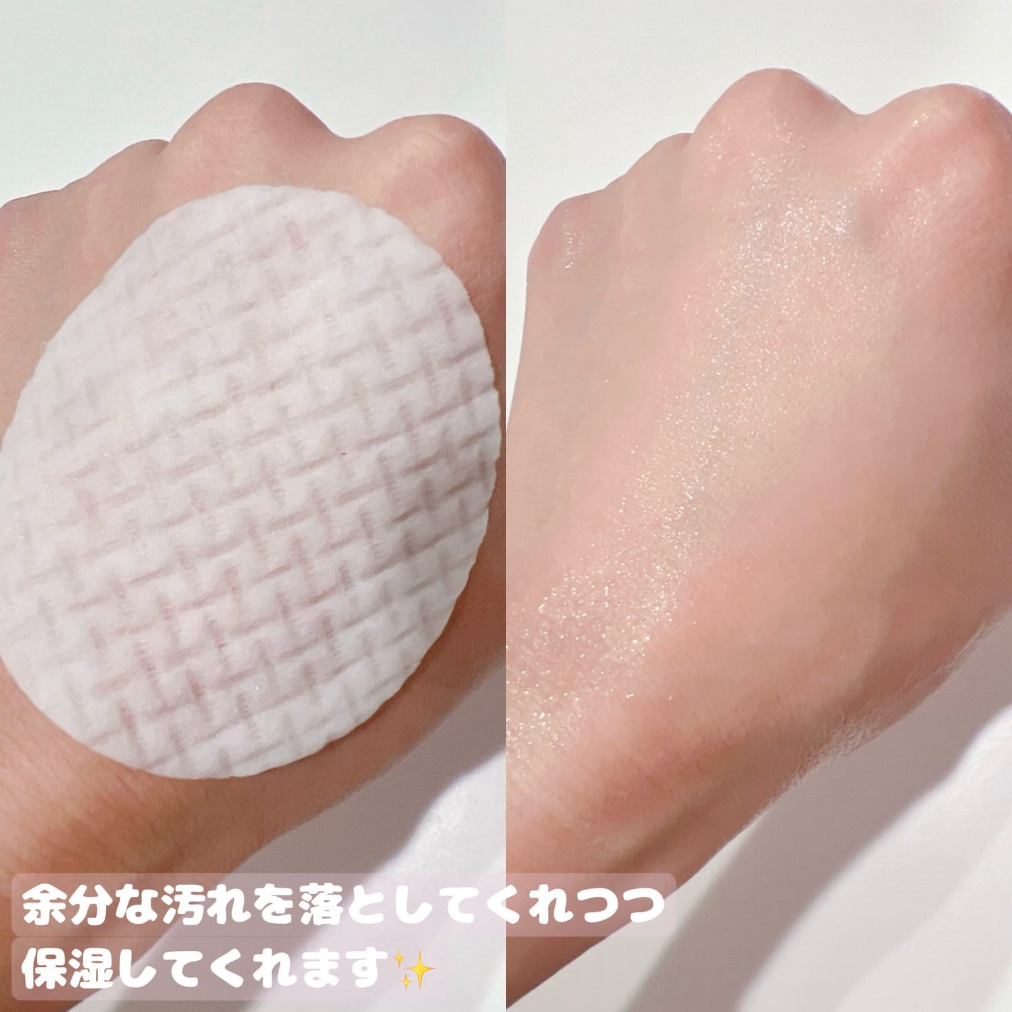 ルルルン トナーパッド ふきとりOFF/ルルルン/トナーパッドを使ったクチコミ(2枚目)