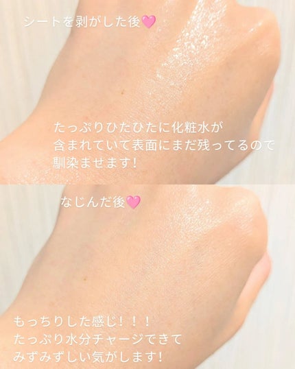 ルルルン ハイドラ EX マスク/ルルルン/シートマスク・パックを使ったクチコミ(5枚目)