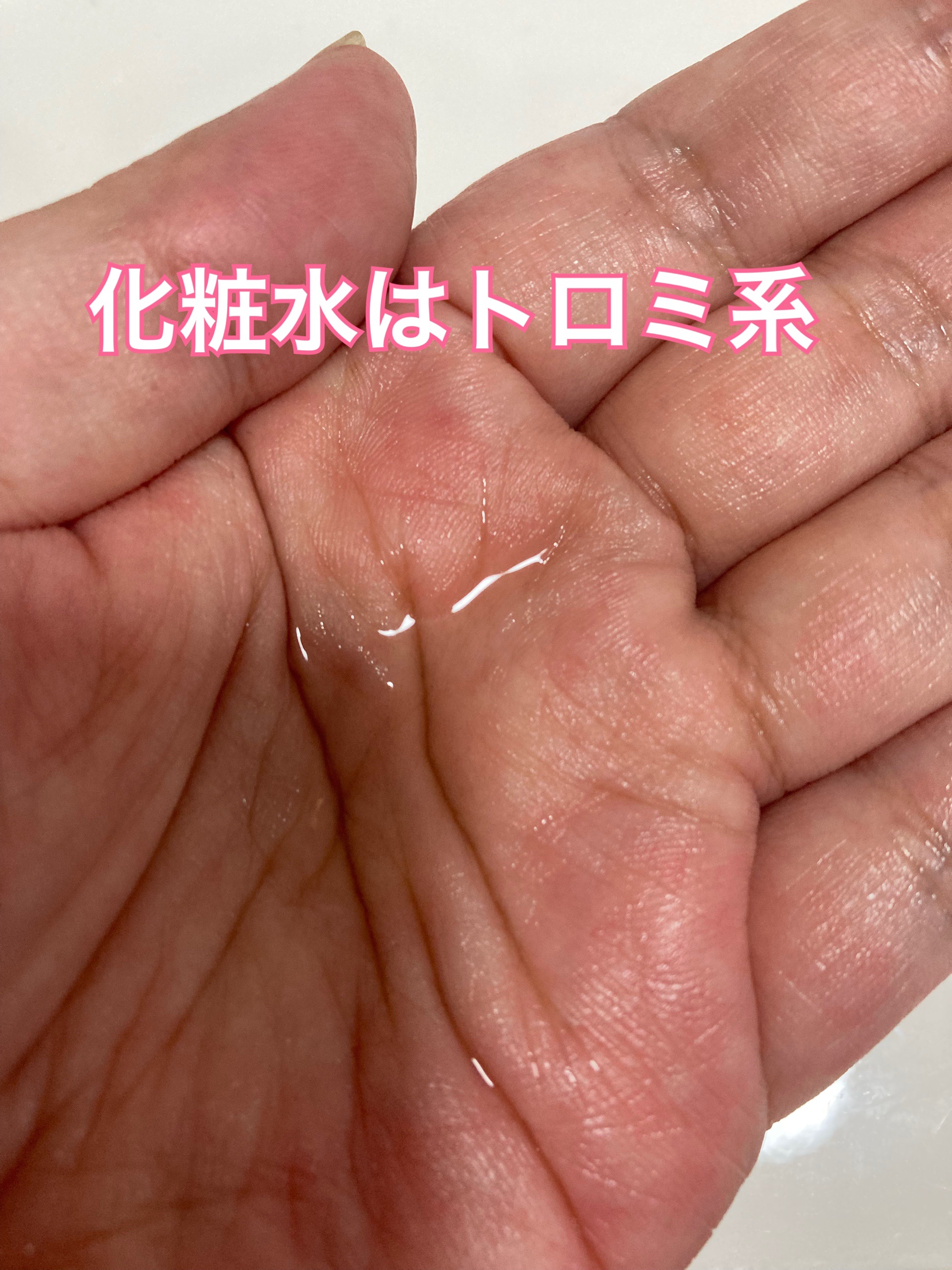 ダーマレーザー スーパーAZ100ローション/クオリティファースト/化粧水を使ったクチコミ（3枚目）