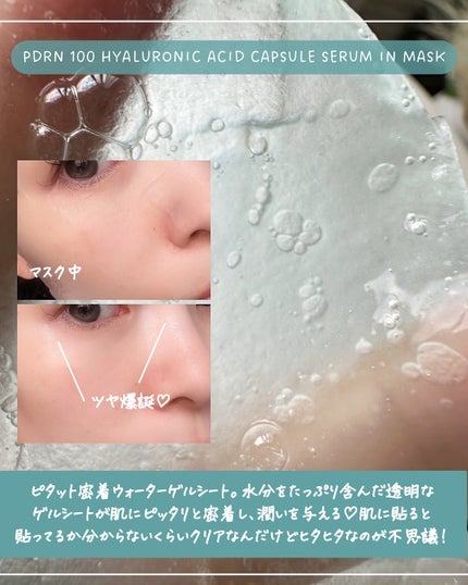 アヌアPHセラムインマスク/Anua/シートマスク・パックを使ったクチコミ(5枚目)