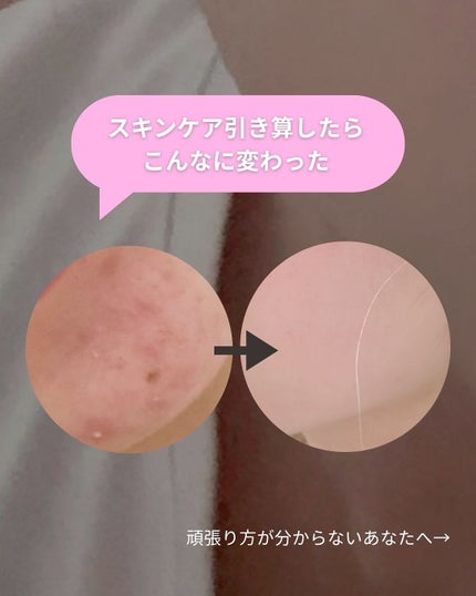 Yuka¦アラサーからの頑張らないスキンケア on LIPS 「こんにちは♪"アラサーからの頑張らないスキンケア"について発信..」(7枚目)