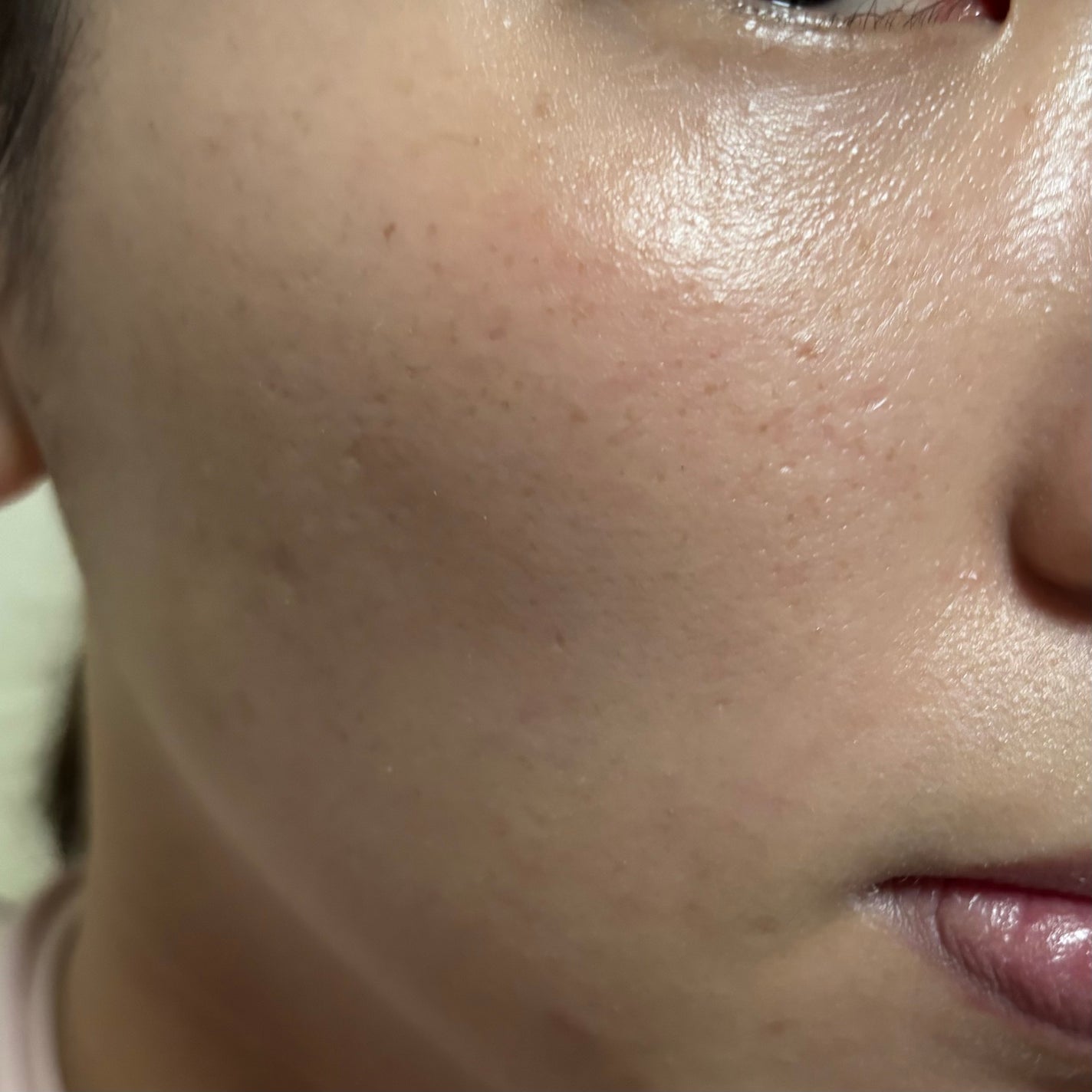 UVã€ã㢠XL ãããã¯ã·ã§ã³ããŒã³ã¢ãã ããŒãº+/ã© ããã·ã¥ ããŒ/æ¥çŒãæ¢ãã»UVã±ã¢ã䜿ã£ãã¯ãã³ãïŒ3æç®ïŒ