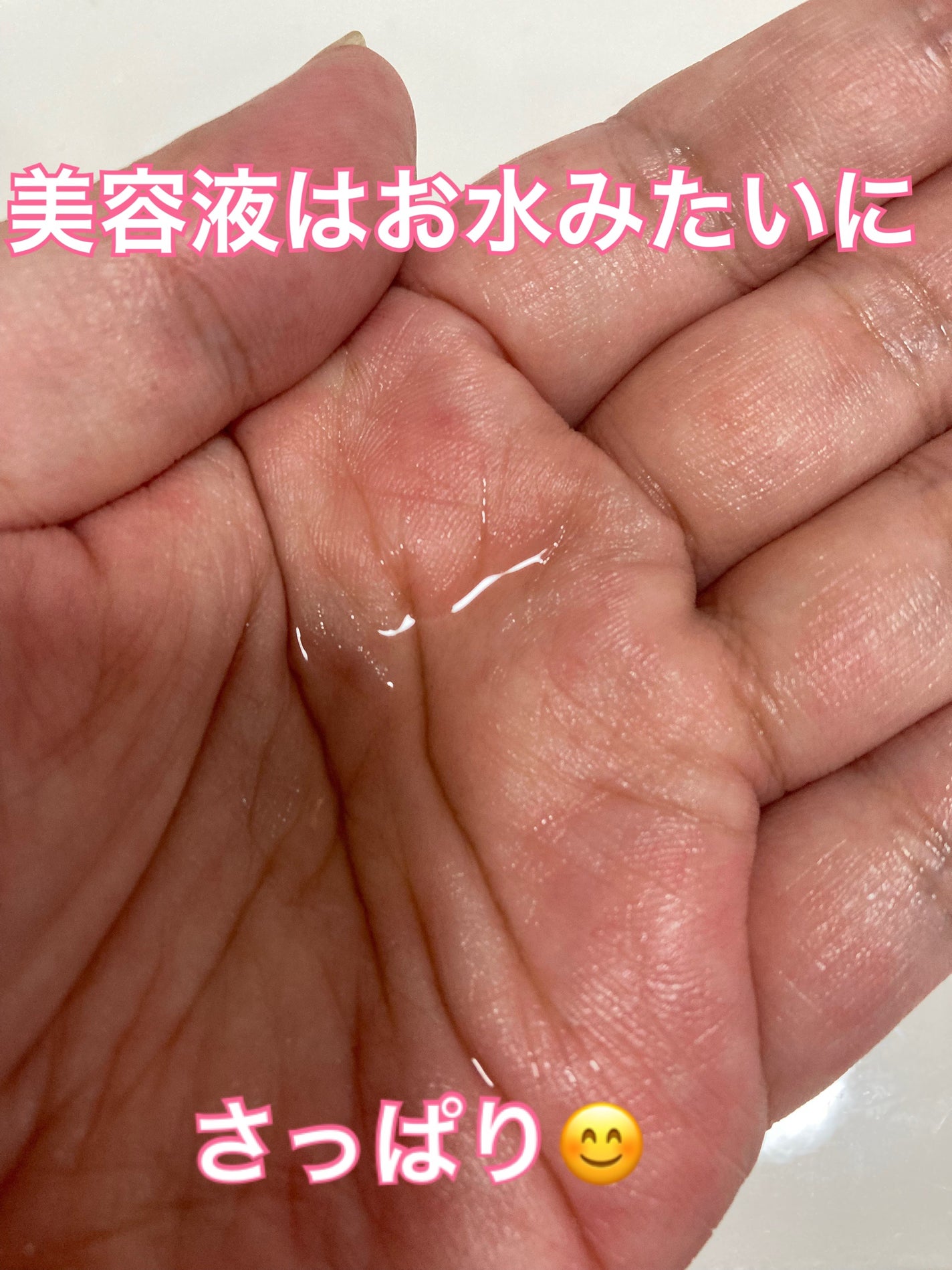 ダーマレーザー スーパーAZ100ローション/クオリティファースト/化粧水を使ったクチコミ(4枚目)