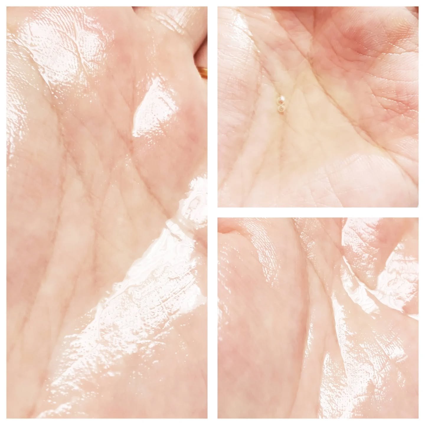 薬用 メディカル アンチヘアロスセラム/L&#39;OCCITANE/頭皮ローションを使ったクチコミ（3枚目）