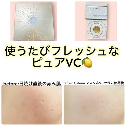 GALÉNIC ガレニシューティカル No.1 VC セラム/Galénic/美容液を使ったクチコミ(1枚目)