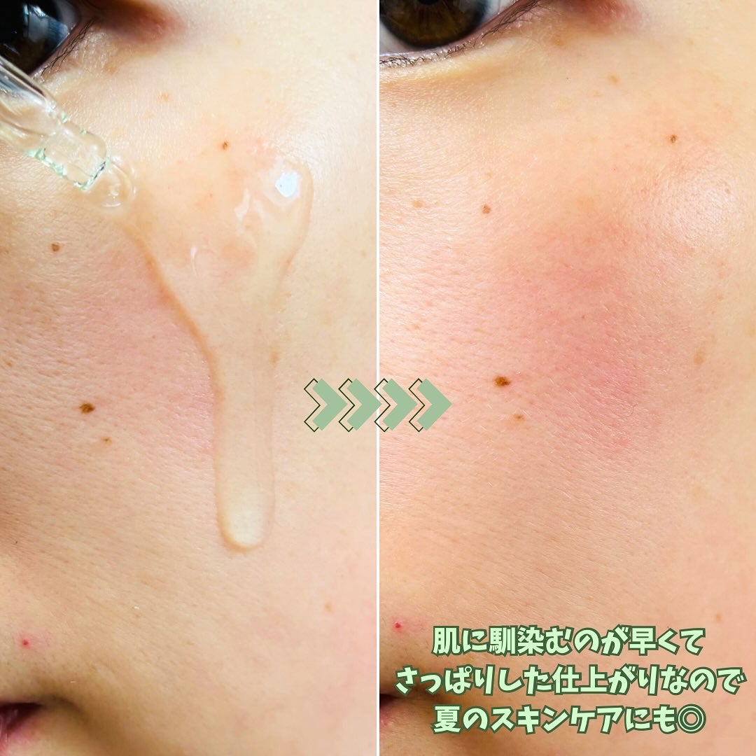 Hydra Forte Ampoule/essenciel/美容液を使ったクチコミ(4枚目)